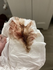 Am I about to miscarry? Pics included TMI