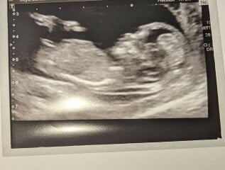 Is it a boy or girl?