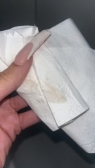 Implantation bleeding? TMI