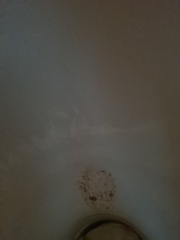 Scared , Brown bitty discharge for 5 days