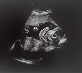 What do you think my baby is from 20 week scan?