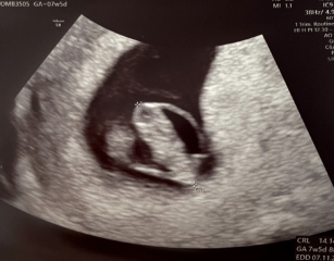Gender guesses? Nub theory/ramzi  