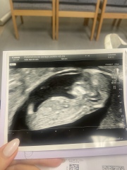 Any guesses on gender?