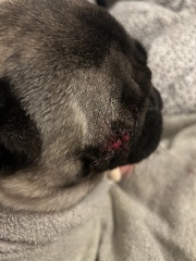 Eye removal day 8 bleeding/torn TW Blood