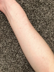 Help! What is this rash? *pictures attached*