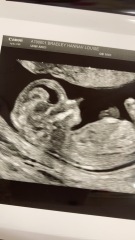 Any guesses on gender