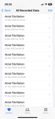 Apple Watch - Arterial Fibrillation 