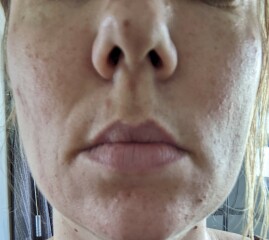 Help! My skin is awful