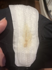 Funny discharge - 27 weeks pregnant *PICTURE WARNING*