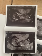 Skull/nub theory guess 👶🏼🍼