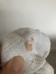The most brilliant thing just came out of my scalp 😃 (pic included)