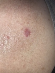Strange lump? 