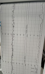 Due April/May after loss - thread 2 🌈🌈