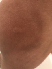 What is this skin thing?