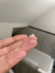 Pregnancy discharge or plug? Pictures