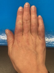 Anyone know what's wrong with my hands