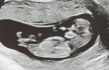 Due October 2023 - thread 4