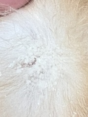 Is this dandruff?