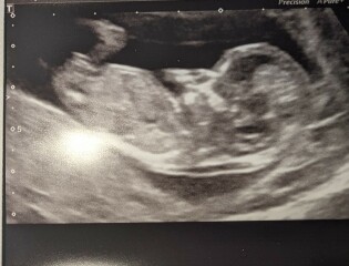 Is it a boy or girl?