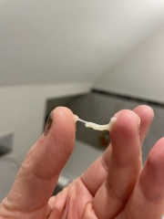 Pregnancy discharge or plug? Pictures