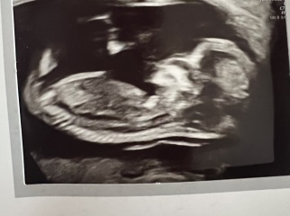 What do you think my baby is from 20 week scan?