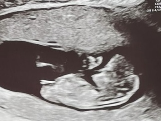 Due October 2023 - thread 4