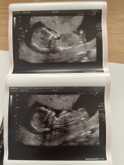 Skull/nub theory guess 👶🏼🍼