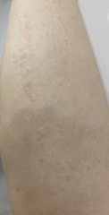 What could this rash be?