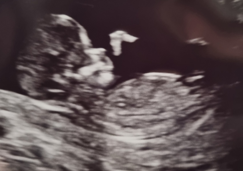 Nub theory / gender prediction 