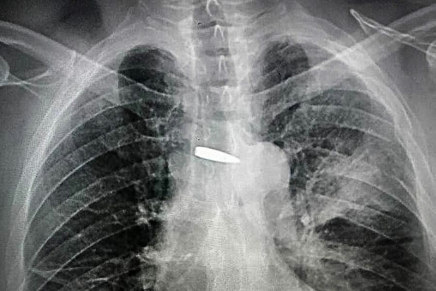 Ukraine Invasion: Part 40