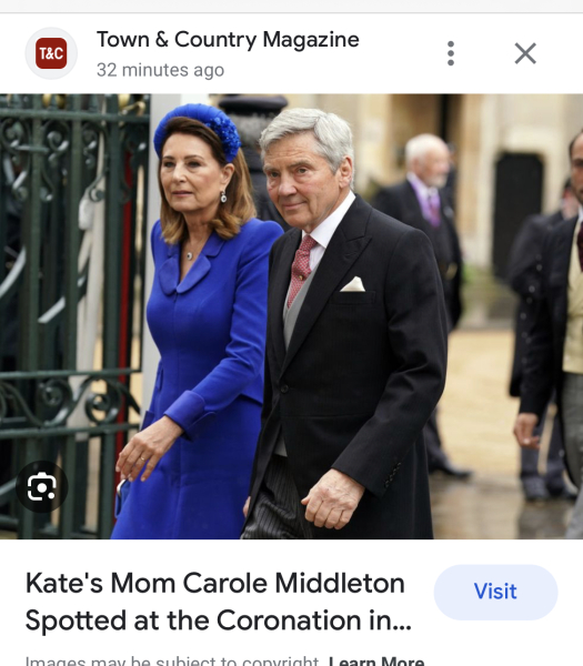 Has Mrs Middleton Had Filler?