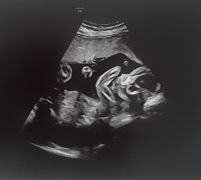 Bump pics at 23 weeks