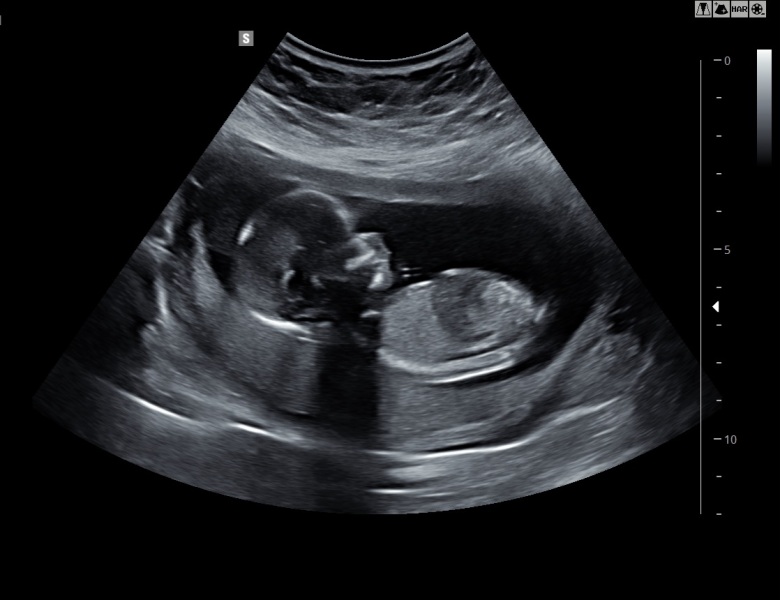 TWW - Testing Around 1st March 