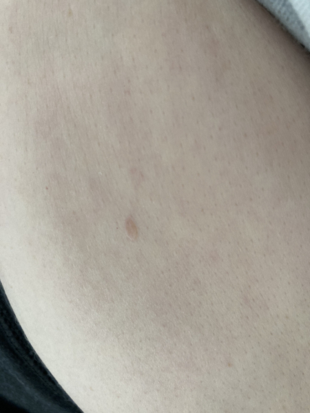 What is this on my hand? 