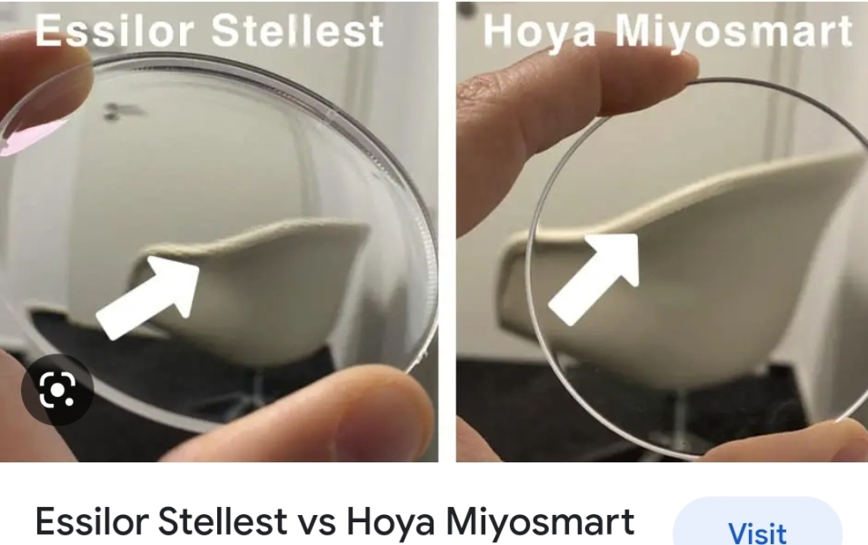 Stellest vs Miyosmart - Optometrist - Myopia Control