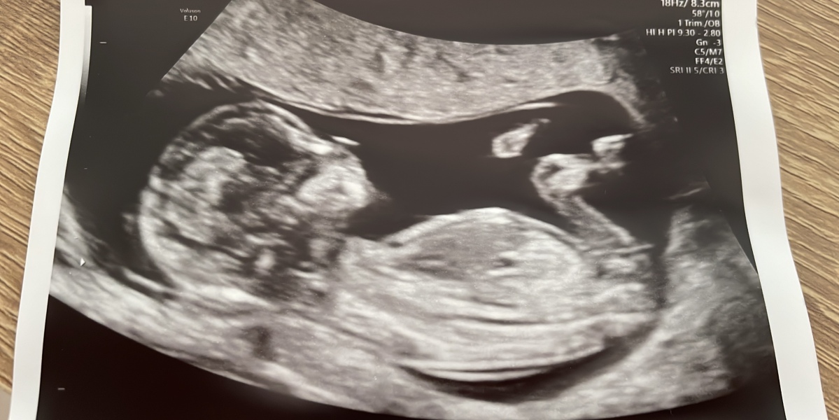Curious to know sex of baby 