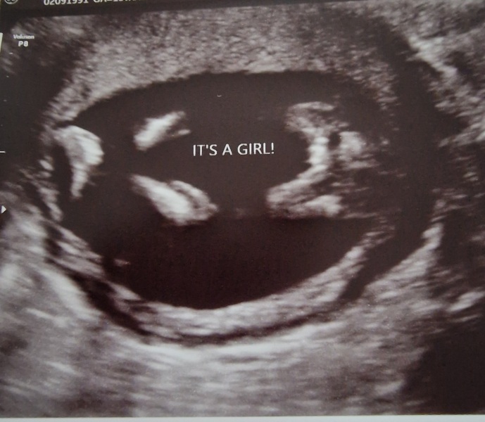 Sure baby Is A Girl?? 💁‍♀️🙈