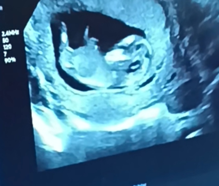 Can anyone guess? 12 week scan
