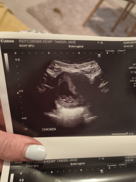 What gender do we reckon?