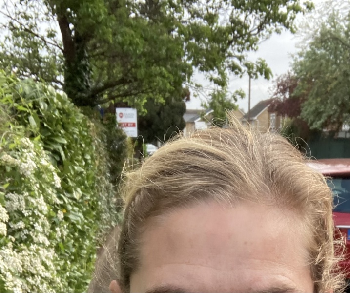 Age is not being kind… with pic! Botox needed, and what else??