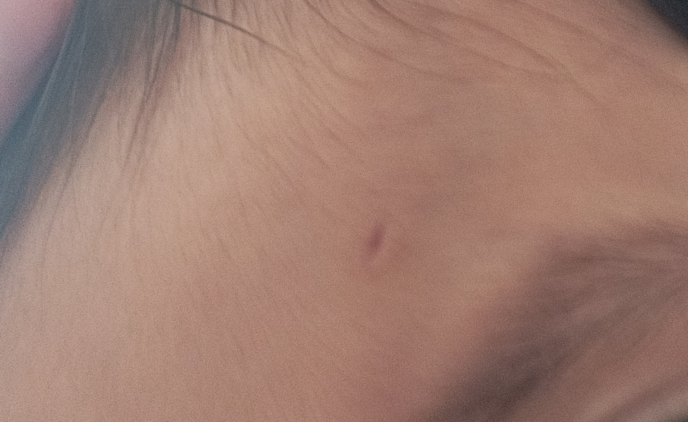 Heal scar/mark on 1 year olds forehead from fall