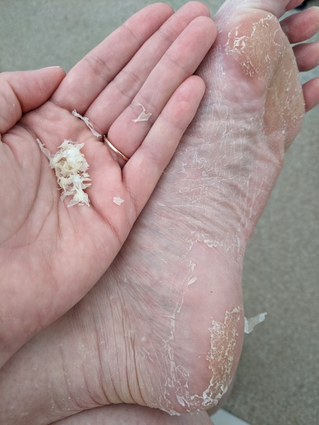 Anyone want to see a gross Footner pic? 