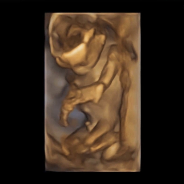 Due October 2023 - thread 6