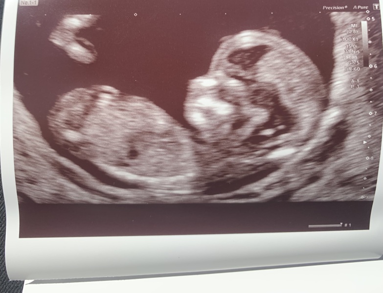 Gender guesses please 