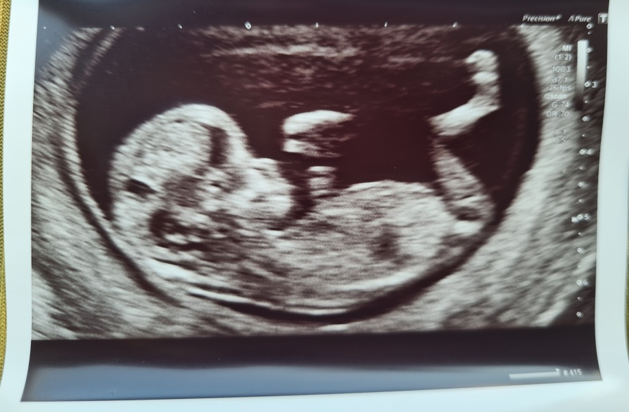 Due November 2023 Part 3