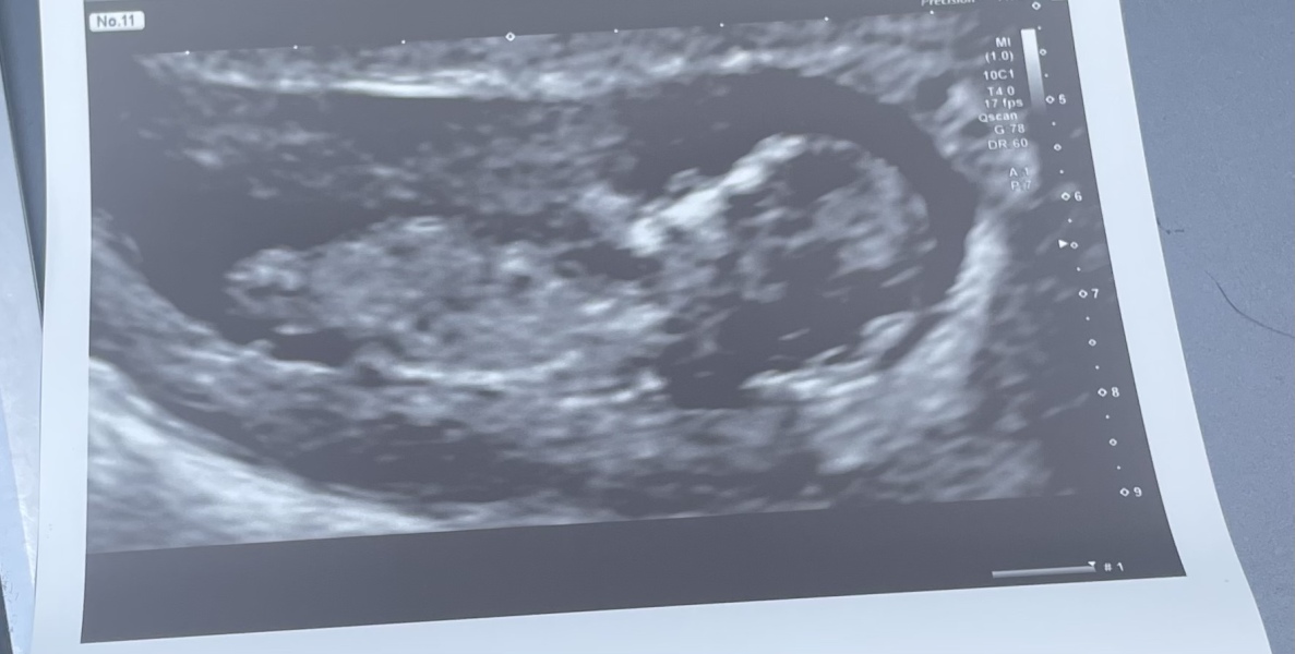 Due November 2023 Part 3