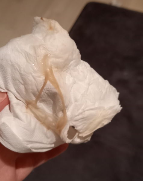 TMI pic loads of mucus??
