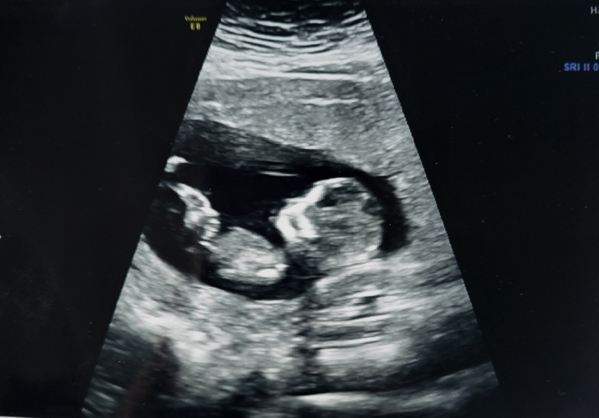 Scan picture