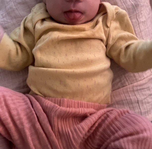 Tongue tie?