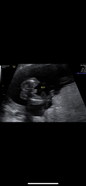 Due October 2023 - thread 6